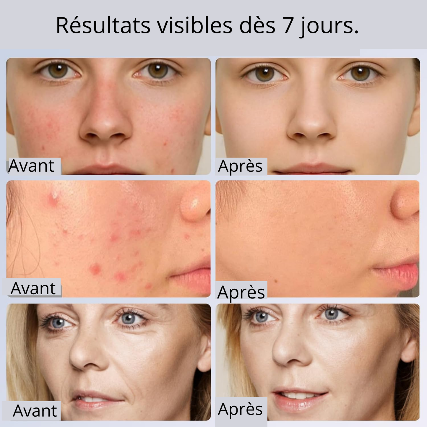 Vita Store - Masque Facial LED