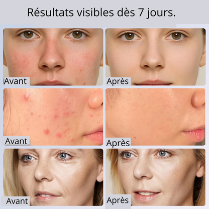 Vita Store - Masque Facial LED